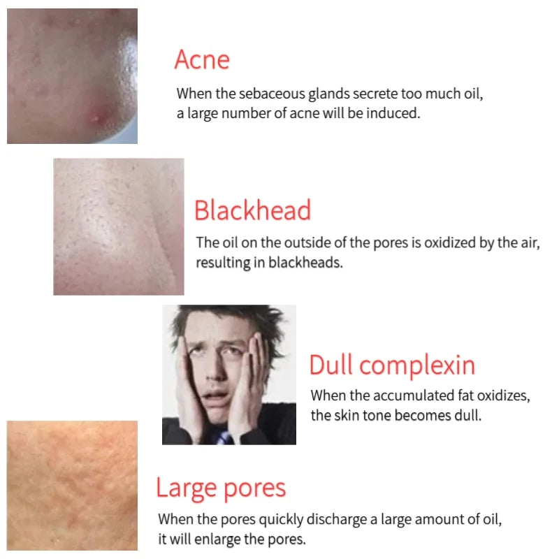 Cat Paw Face Oil Absorbing Roller  Volcanic Stone Blemish Remover Facial Shiny Changing Pores Oil Removal Massage Artifact Tools